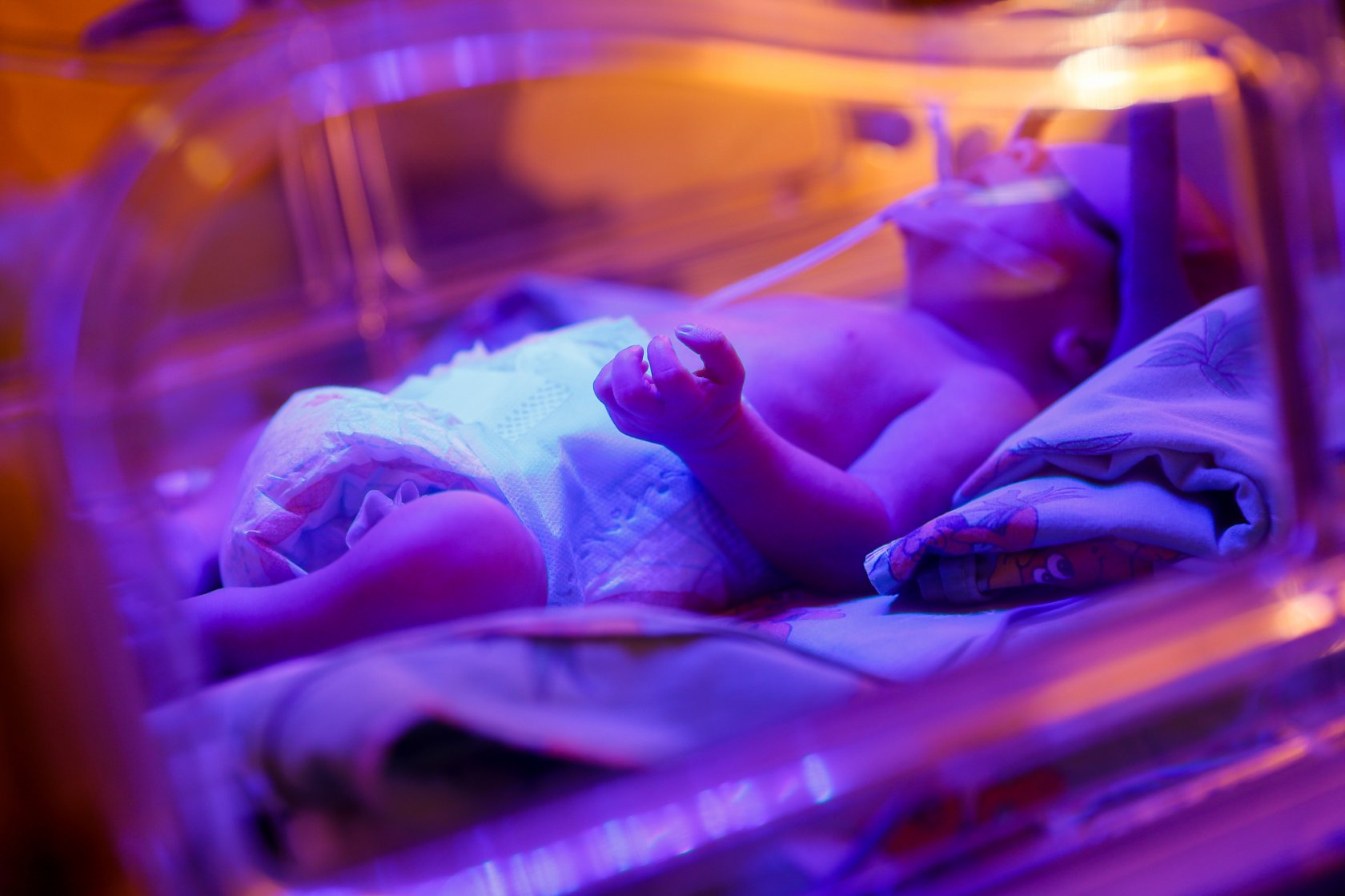 Люди родившиеся ночью. Недоношенный новорожденный. Ребенок внутриутробно фото. Асфиксия новорожденных. Недоношенный ребенок на ладошке.