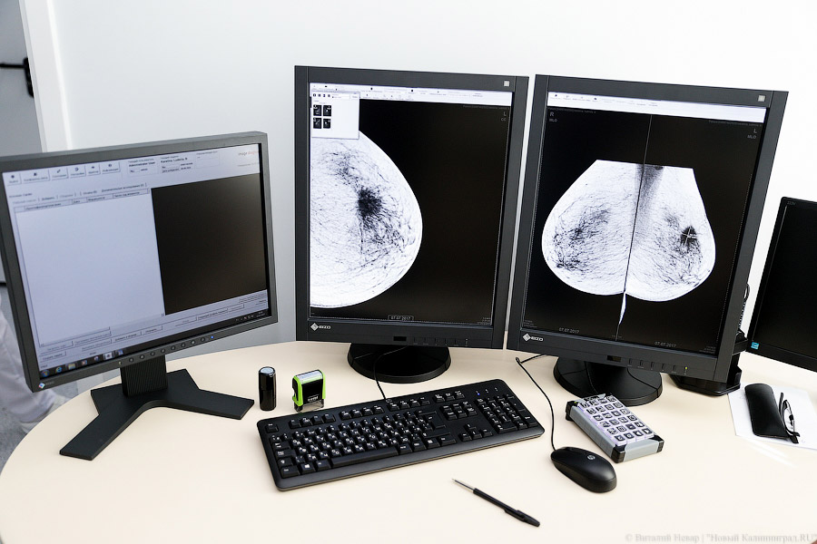 Выявить вовремя: в Центре женского здоровья за 3 месяца нашли рак у 40 женщин