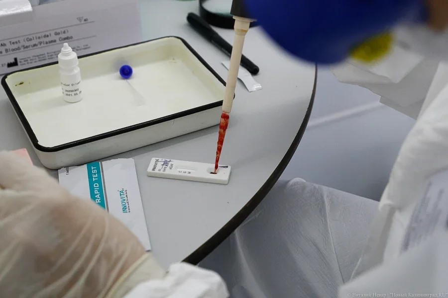 В Калининградской области за сутки зарегистрировали 67 случаев коронавируса