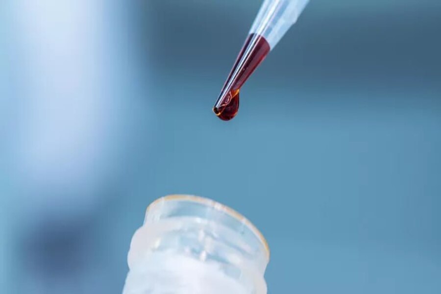 Ученые БФУ им. Канта предложили диагностировать патологии по профилю крови 