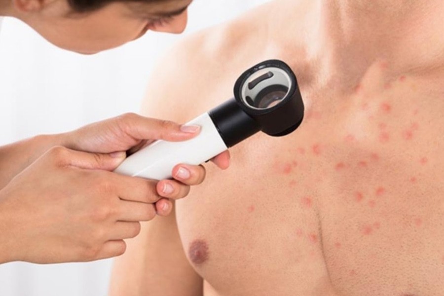 Что делать при хронических неинфекционных заболеваниях кожи