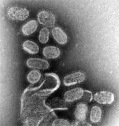 В Калининградской области началась эпидемия гриппа