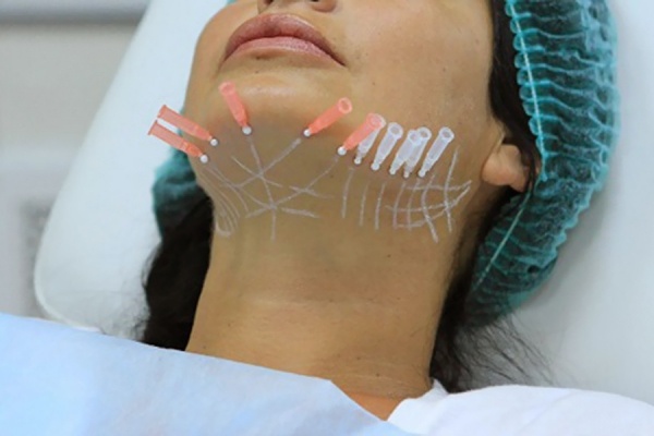 Пойти на все ради красоты: стоит ли жертв гонка за вечной молодостью