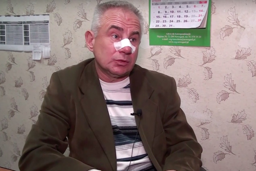 Глава Приморска заявил, что полицейские сломали ему нос (видео)
