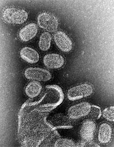 В Литве установлен первый случай заболевания свиным гриппом