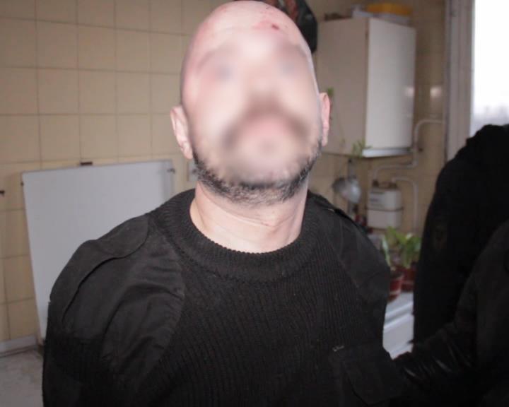 В Калининграде 40-летний мужчина ранил свою сожительницу из карабина времен ВОВ (фото)