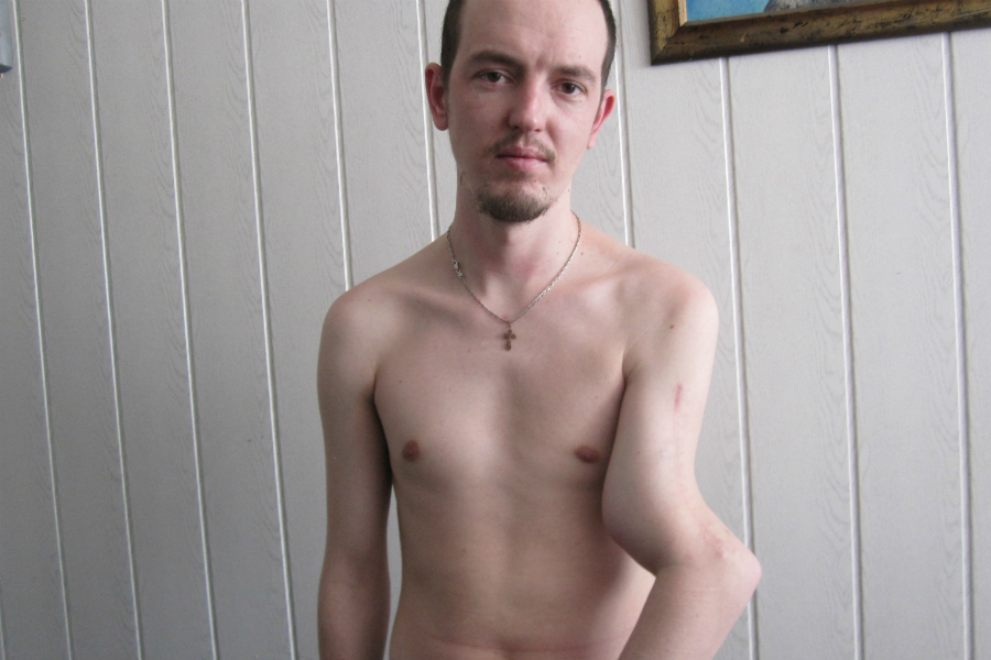 Угроза ампутации: в Калининграде сотрудников УФСИН обвинили в жестокости