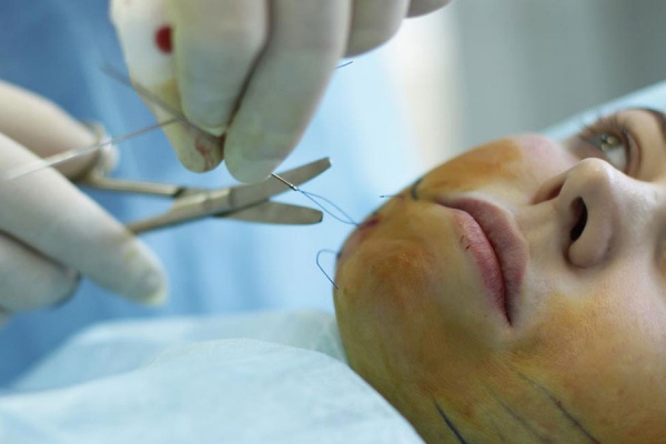 Нужна ли жертва ради красоты: к чему приводит желание выглядеть молодо