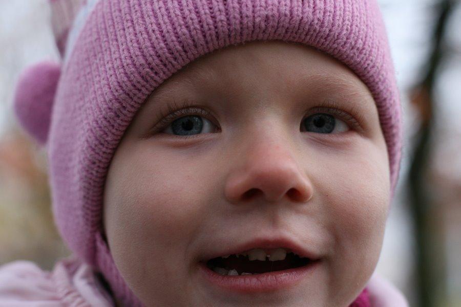 "Девочка с "кусючками": репортаж "Нового Калининграда.Ru"