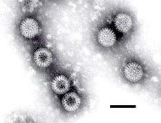 Ротавирусная инфекция распространилась в 45 детских учреждениях Калининграда