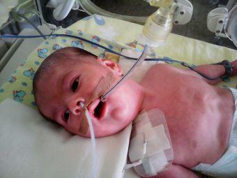 Мама Глеба, 4 месяца лежащего в реанимации ДОБ: ребенка не дают отправить в Москву