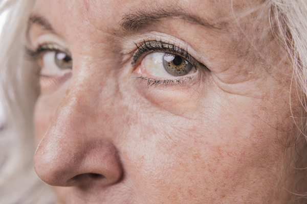 Синдром уставшего лица: из-за чего мы выглядим старше своего возраста 
