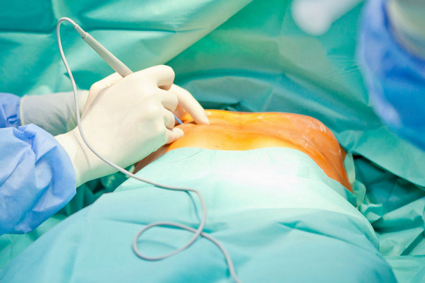 Акция от VIP Clinic: грудь «под ключ» — 180 000 рублей