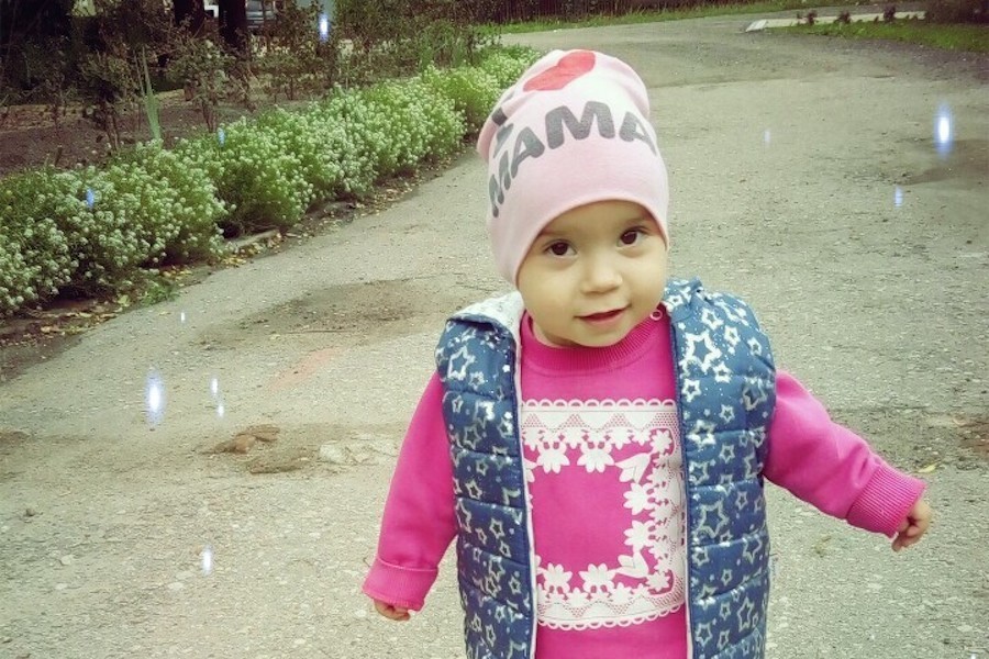 Годовалой девочке из Черняховска нужны деньги на исправление деформации черепа
